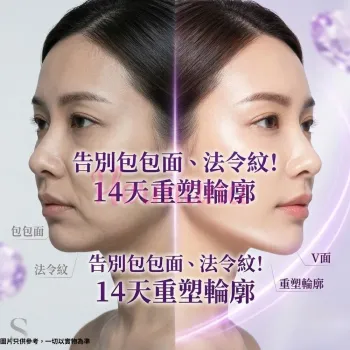 Sliswiss 幹細胞 Hifu 皇后面霜 50ml