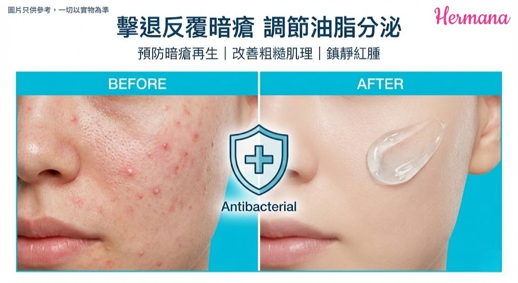 BIO-C-ZIWI 消炎去印 控油效果對比