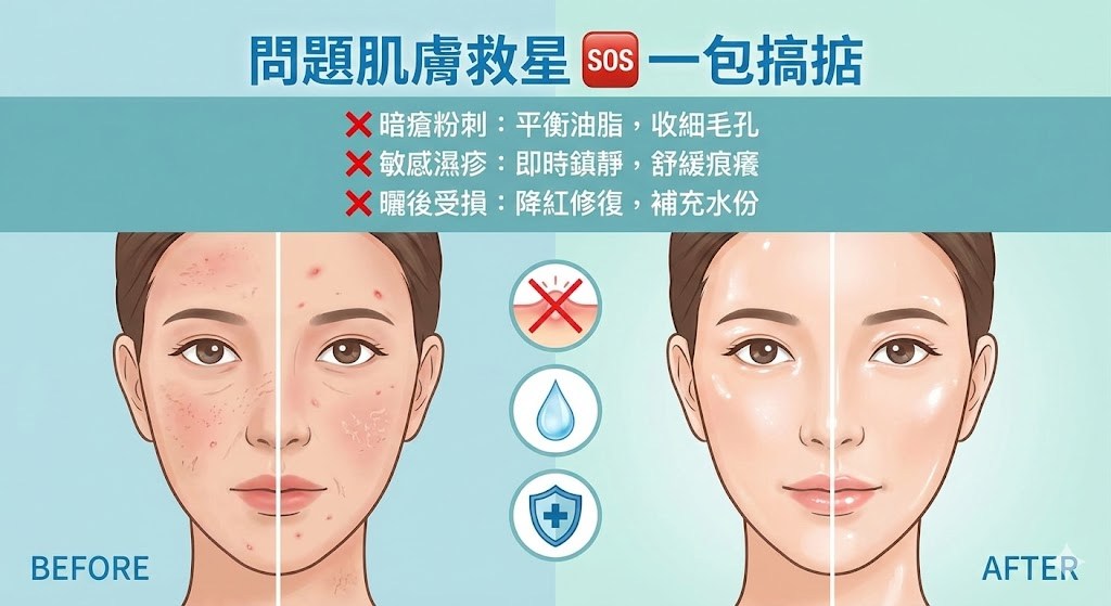 解決暗瘡、濕疹、曬後紅腫問題